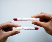 hands holding blood vials one says positive, the other says negative