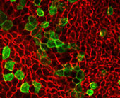 Photo of Brown adipocytes derived from progenitors expressing the Trpv1 receptor.