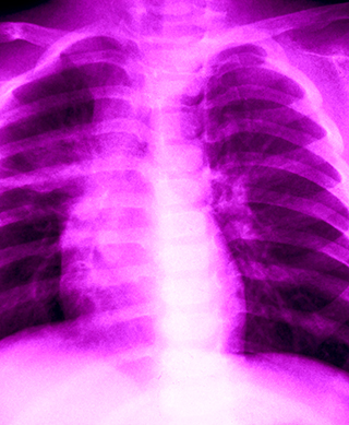 Chest x-ray illuminated in violet