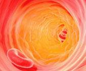 Illustration of an artery with plaque buildup 
