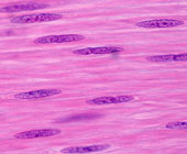 smooth muscle cells shown with pink wash