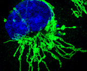 Cancerous epithelial cells