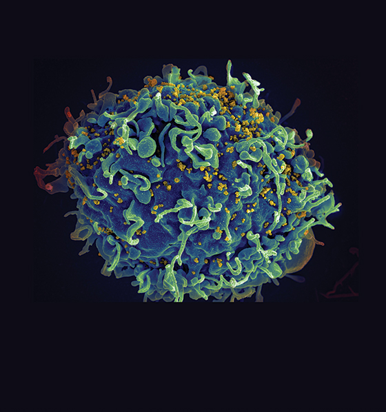 HIV