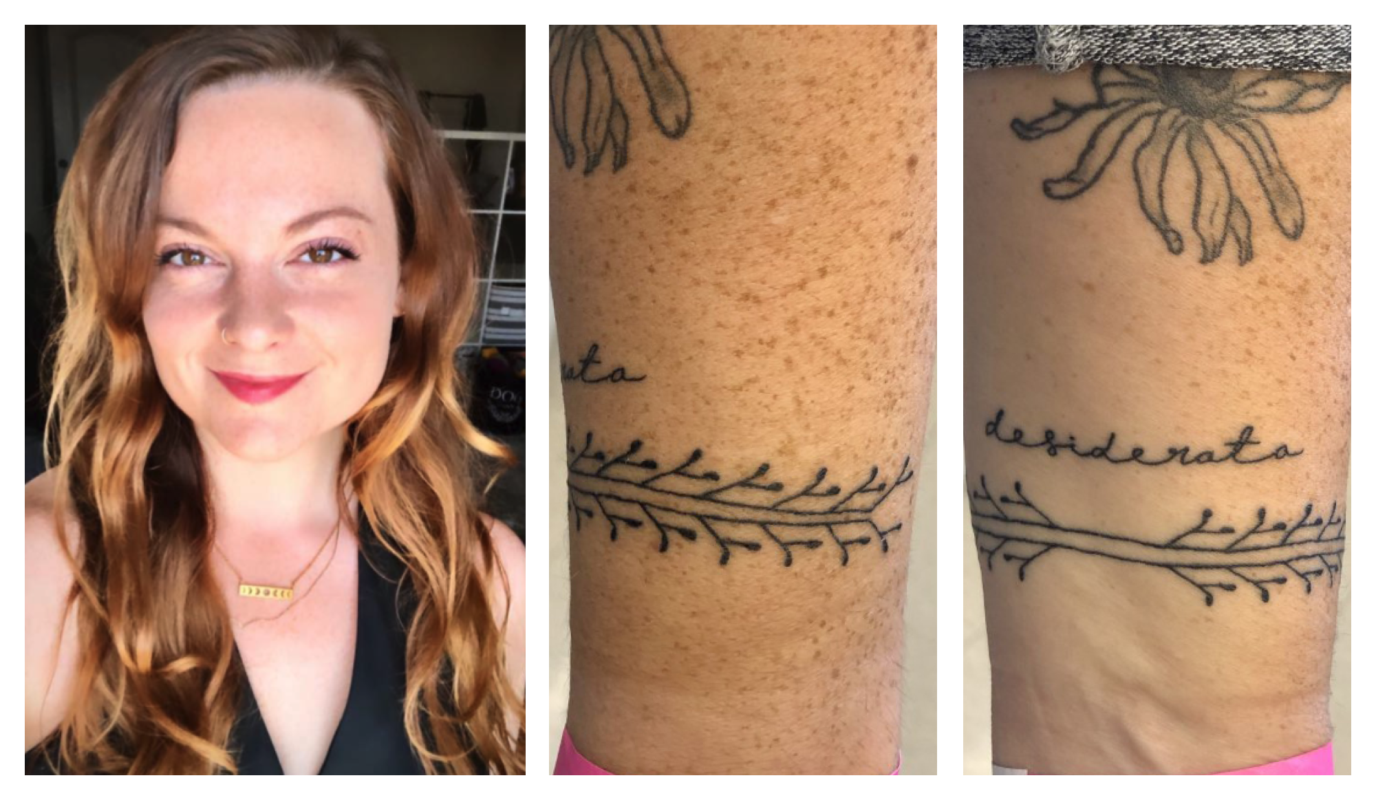 Photo collage of Amber Mueller's tattoo of a Myosin heavy chain polymerization