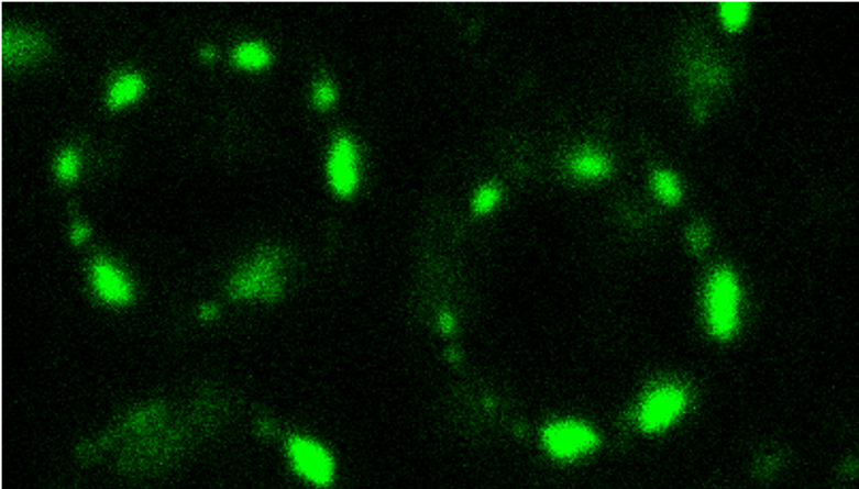 Fluorescent microscope image shows dotted green rings against a black backdrop