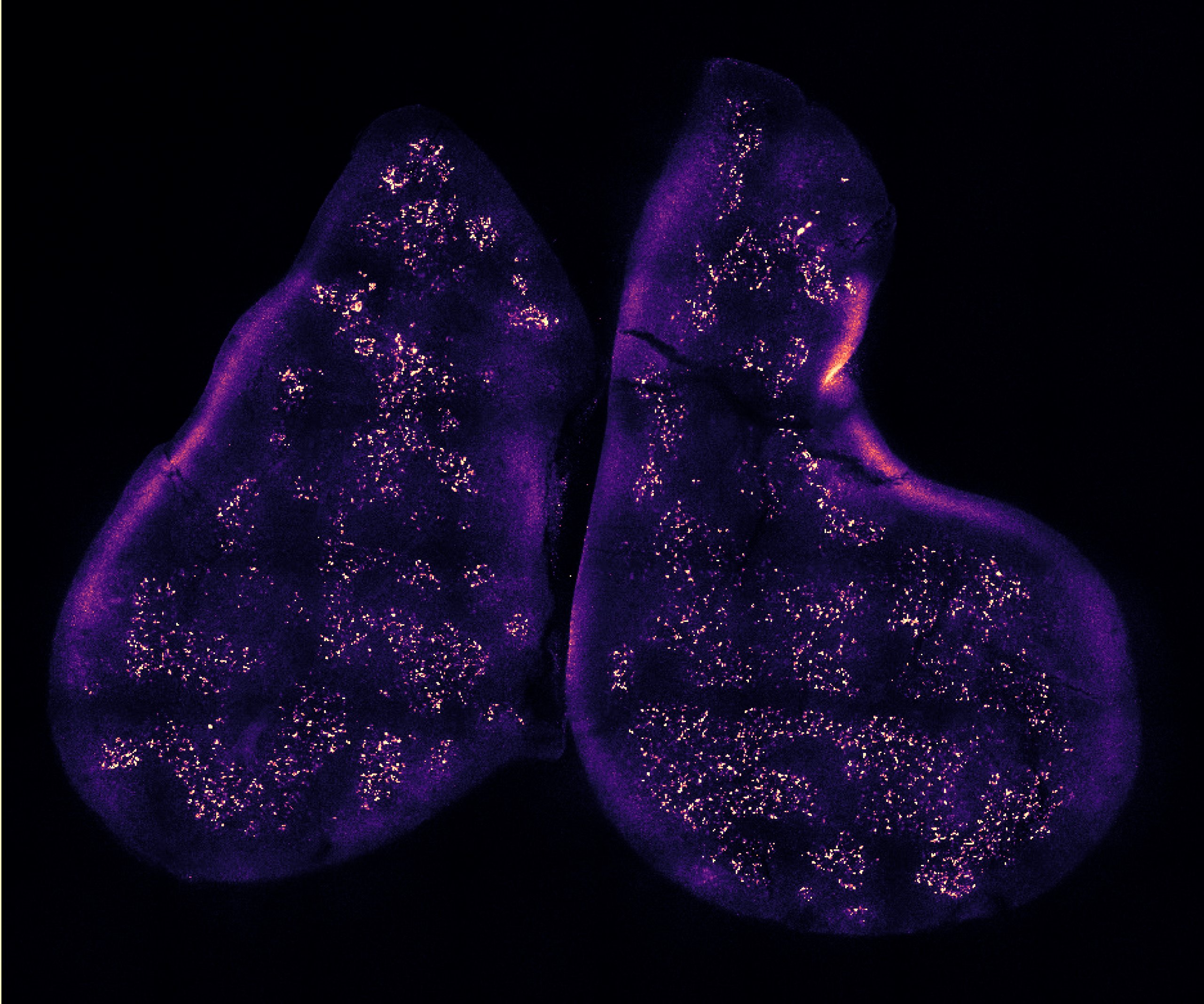 image of the thymus gland