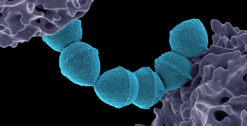 Colorized microcsope image shows six knob-like bacteria on a string