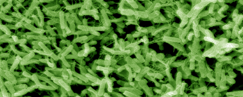 Microscope image shows a mesh of rod-shaped bacteria filling the screen