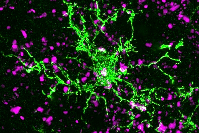 microscope image of a cell spreads out bright green against a dark background, while synapses between cells appear as scattered purple patches throughout the image