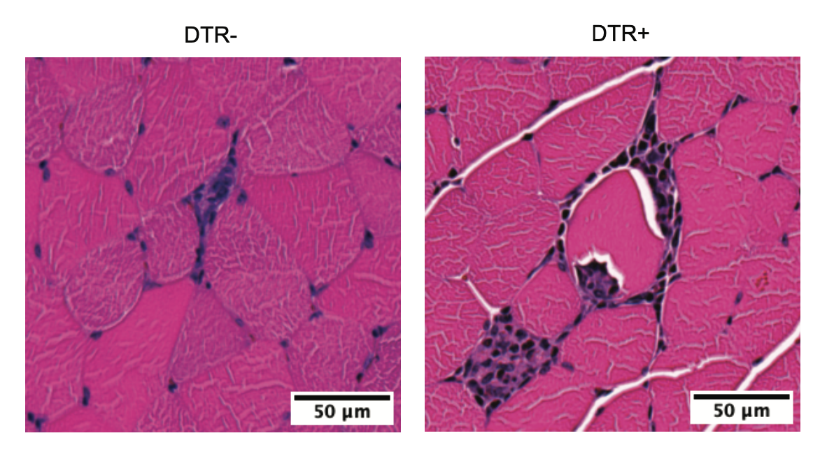 Two images comparing inflammation in hindleg muscles of mice