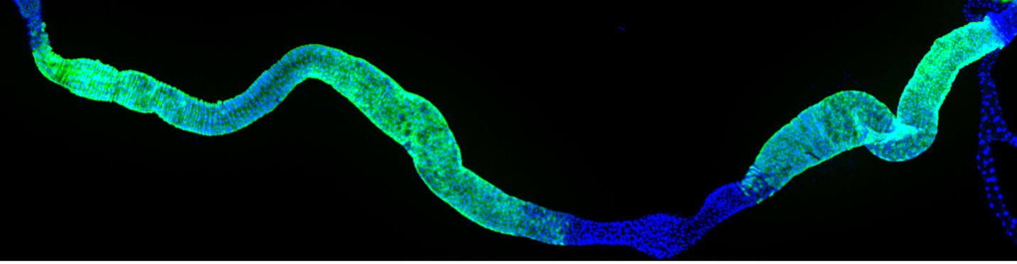 Fruit fly gut cells glow green and blue in a microscopy image against a dark background