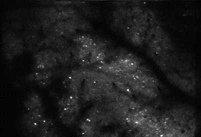 A grayscale image showing a cloud-like group of neurons lighting up