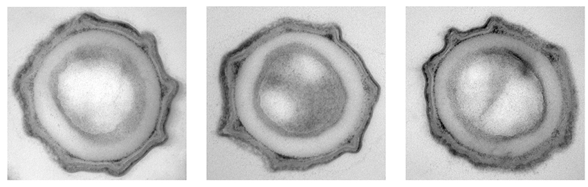 micrographs show three close-up views of dormant bacterial spores