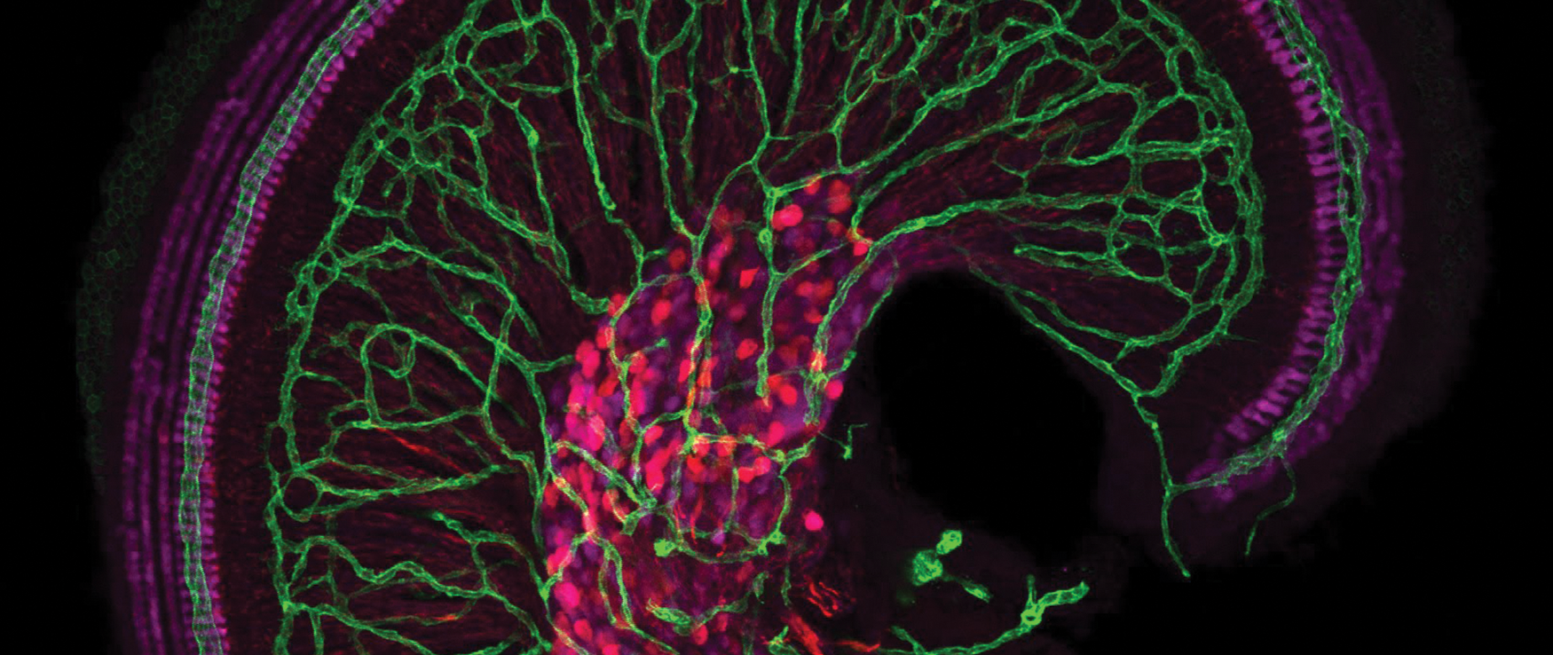 The apex of the snail-shaped cochlea, our hearing organ, with its dense vascular network (green) is shown here. The hair cells (magenta), which detect sound, are innervated by the primary auditory neurons, whose cell bodies and axons are also in magenta.