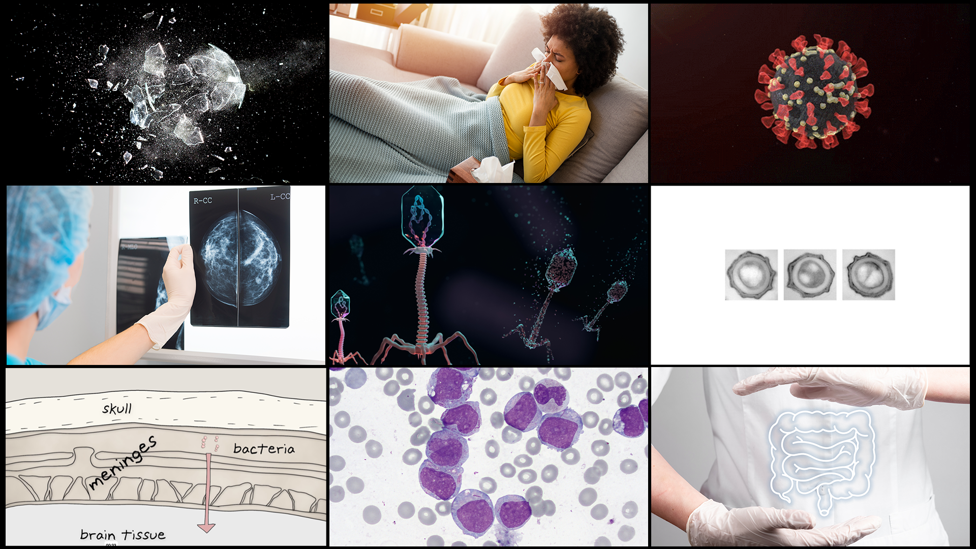 A grid of nine images, including breaking glass, a woman blowing her nose, a SARS-CoV-2 particle, illustration of phage viruses, microscopy images of bacterial spores, and an illustration of the meninges