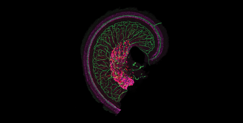 The apex of the snail-shaped cochlea with dense vascular network shown in green, as well as hair cells and cell bodies and axons of auditory neurons shown in magenta.