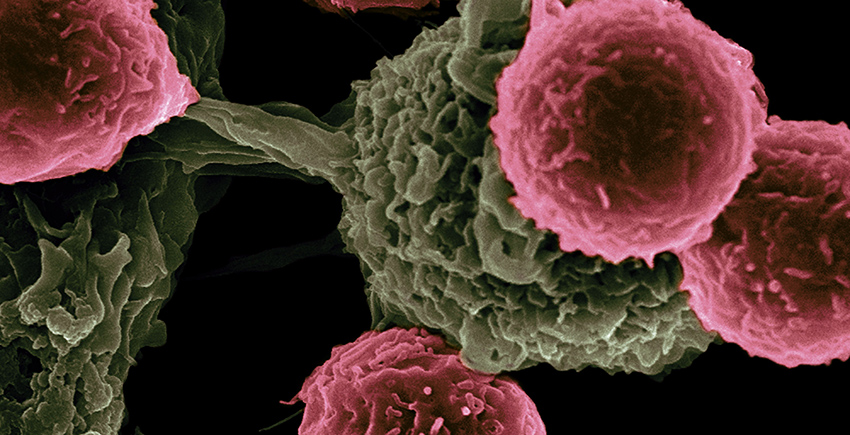 Microscopy image of four spheres (T cells) in front of a large structure with a sphere connected to a main body by a stalk(dendritic cell)