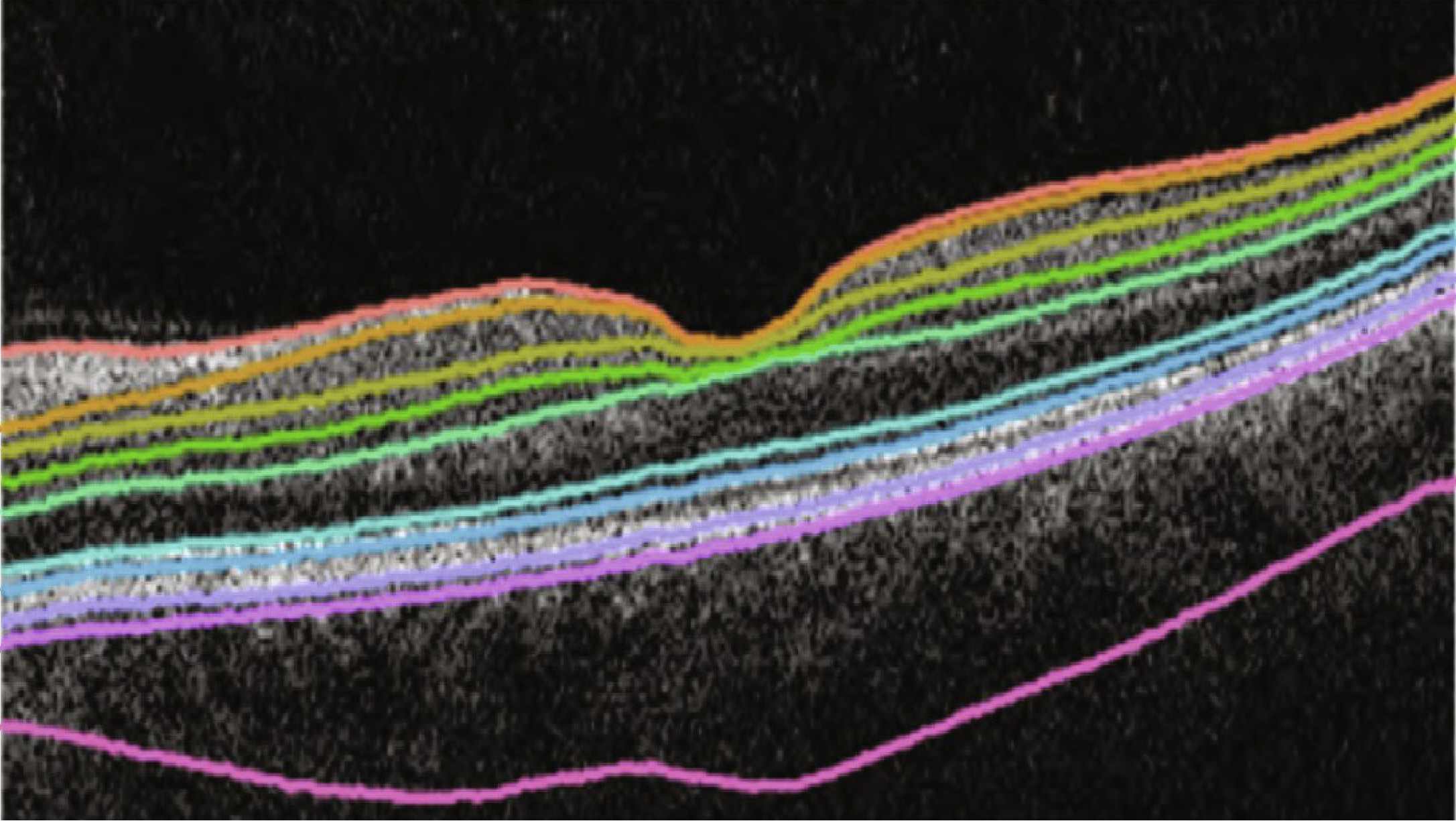 Different colored lines showing thickness layers on a black background