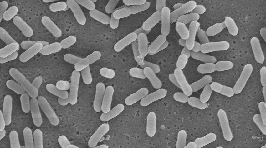 microscope image of dozens of rod-shaped bacteria