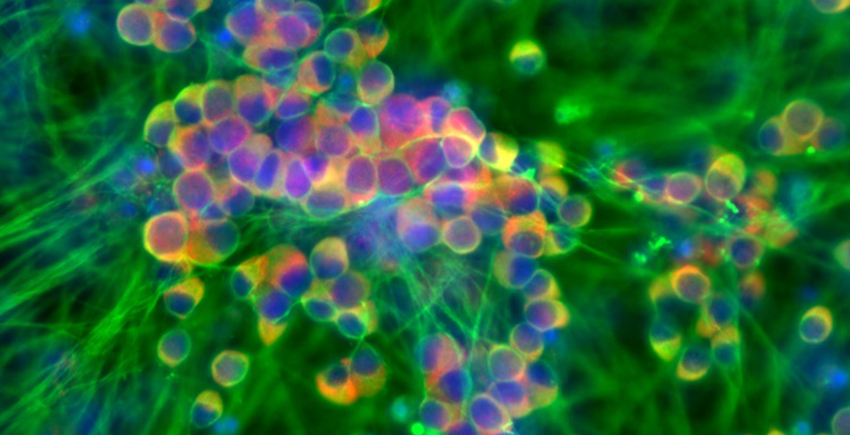 microscope image shows rainbow-tinted tubular cells connected by a network of filaments