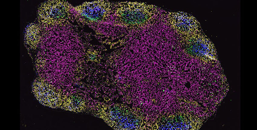 different cell types are fluorescently tagged different colors in a blob-shaped lymph node seen under a microscope