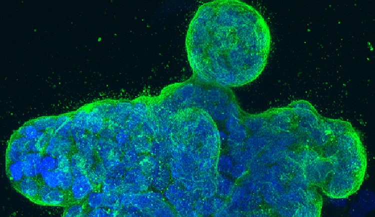 a blobby cluster of cancer cells glows blue with green edges under a microscope