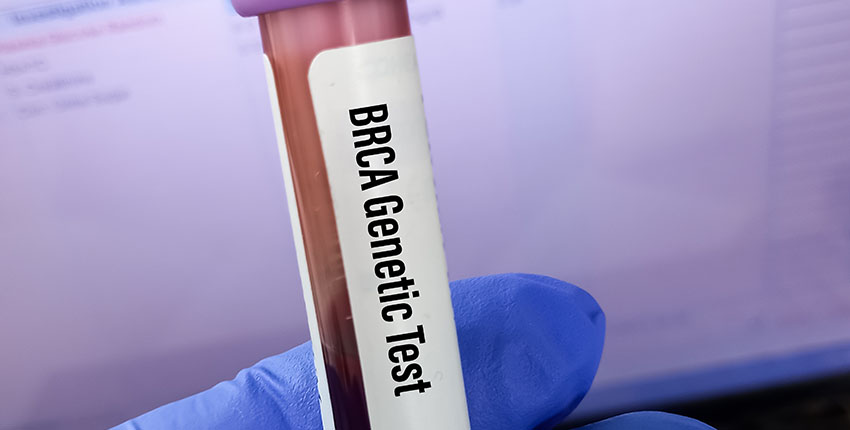 A vial of blood labeled BRCA genetic test