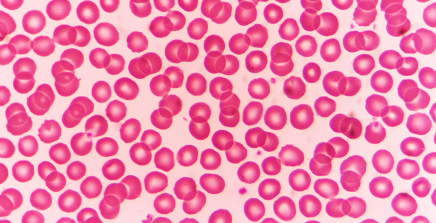 Red blood cells appear as dozens of spheres under a microscope