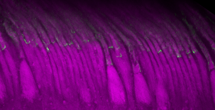 Cells in a row under a microscope have wider bases and long tails bending slightly to the left like reeds in a breeze. Each cell is fluorescently tagged purple with a dot of green about halfway up.