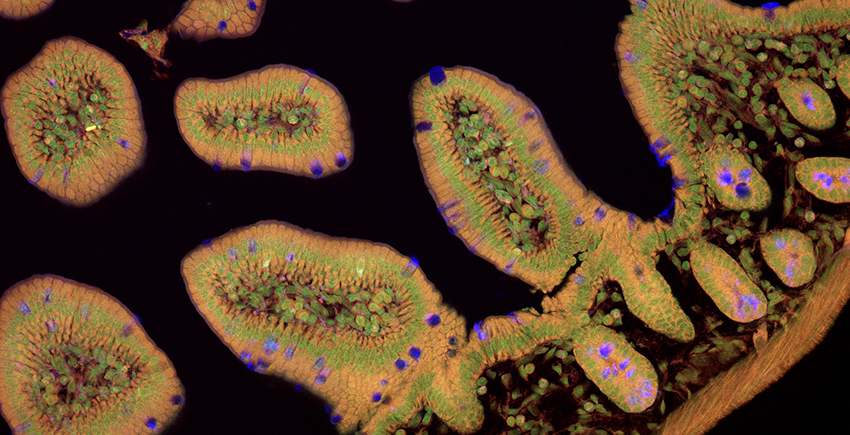 A cross-section of intestinal lining appears like irregular ovals with complex cell structures, shown in brown with green rings and occasional purple cells