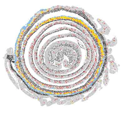 A model of intestinal tissue looks like a gray spiral with some cells highlighted in yellow, red, or blue.