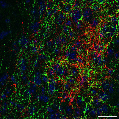 Microscopic view of the brain region responsible for processing sound and touch