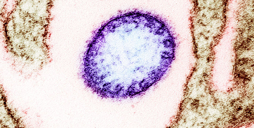 A purple circular Nipah virus particle floats in a field of pink surrounded by brown VERO cells.