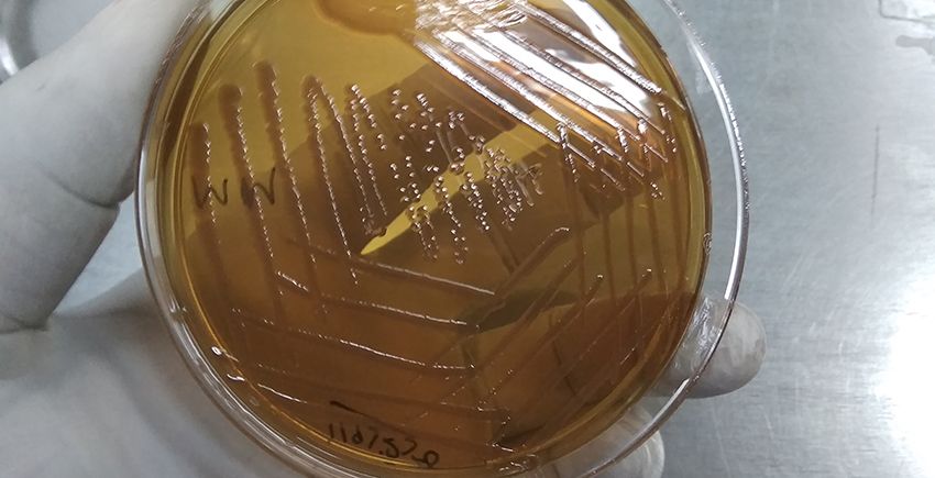 A gloved hand holds a Petri dish with bacteria growing in it