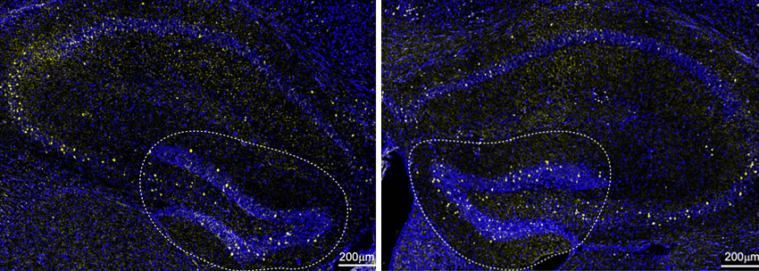 side-by-side microscope images show blue swirls with clusters of yellow dots against a black background