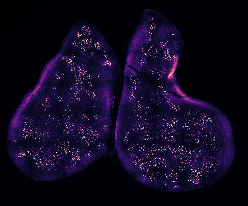The thymus gland, shown here, is the birthplace and training ground of T cells. Image: Daniel Michelson, Mathis/Benoist lab, HMS