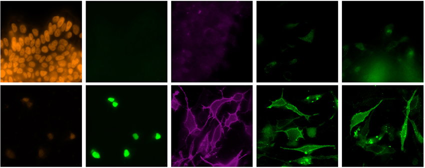 Top row: Untreated stem cells contain a protein (orange) marking its ability to mature into many different kinds of cells. Bottom row: Stem cells given a cocktail of transcription factors to coax them to become microglia-like cells express an array of proteins characteristic of human microglia. Image: Wyss Institute
