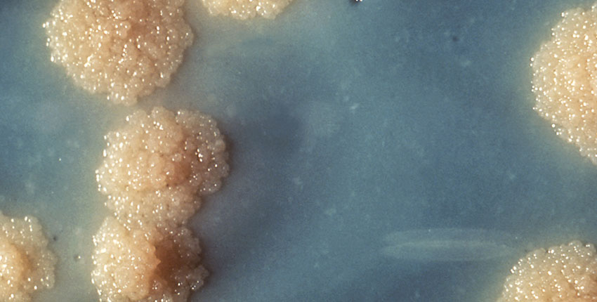 Close-up image of Mycobacterium tuberculosis bacterial colonies growing on a solid nutrient medium. The colonies appear rough, irregular, buff-colored, and bubbly, resembling small cauliflower-like clusters on a blue-gray background.