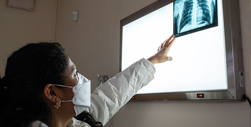 A woman wearing a white coat and a face mask examines a chest X-ray displayed on a lightbox. She is reaching up with her right hand to point at the image, which shows the ribcage and lungs. The setting appears to be a medical or clinical environment.