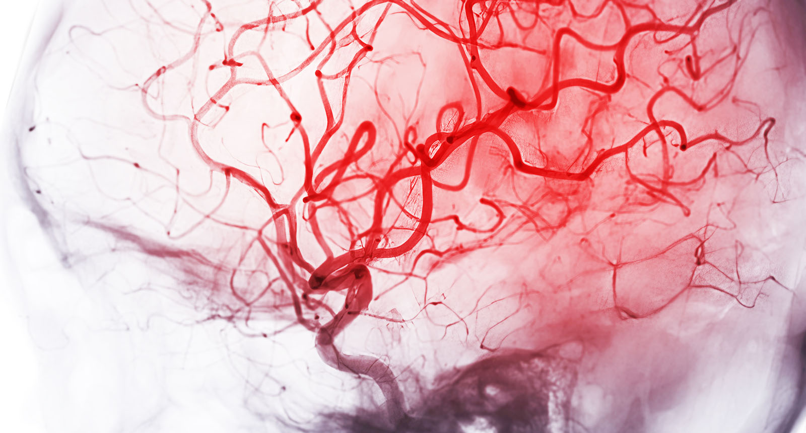 A network of thin red lines on skull-shaped gray background