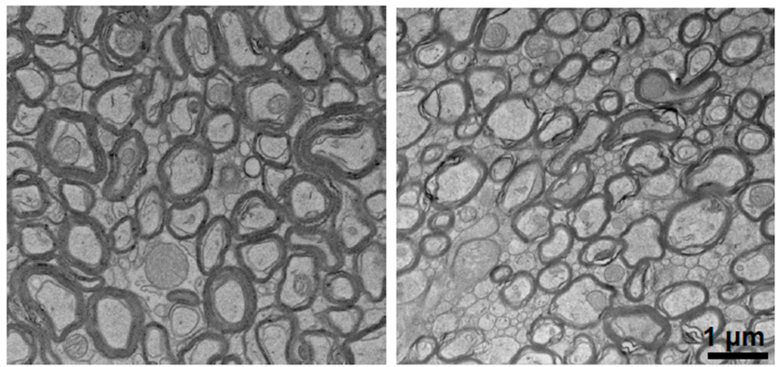 side-by-side grayscale electron microscopy images show thicker cell borders on the left and thinner borders on the right