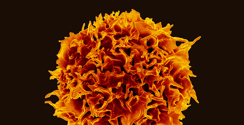 A spherical cell with an irregular surface, colored orange and red against a black background.