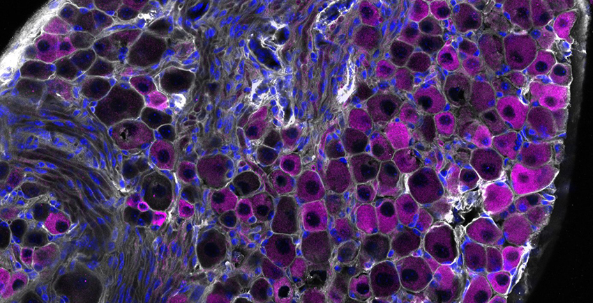Microscopy image of vagus nerve sensory cells