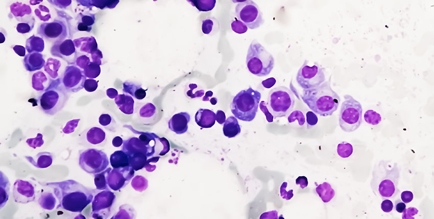 Clusters of purple circles on a white background