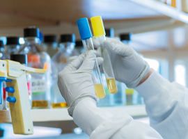 Gloved hands holding two test tubes