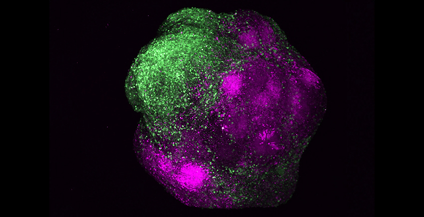 A ball-like structure under a microscope. One side is mostly green and the other mostly magenta.