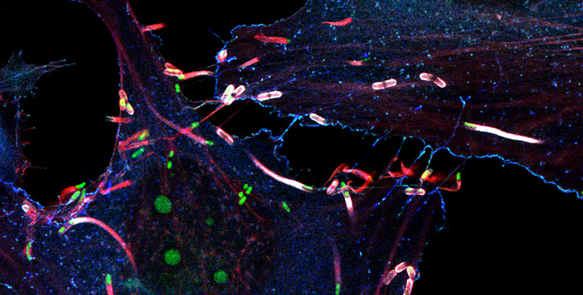 Fluorescence microscopy image of cultured cells showing green listeria trailing red comet tails of actin filaments. The background is black, making the brightly colored bacteria and cellular structures stand out vividly.