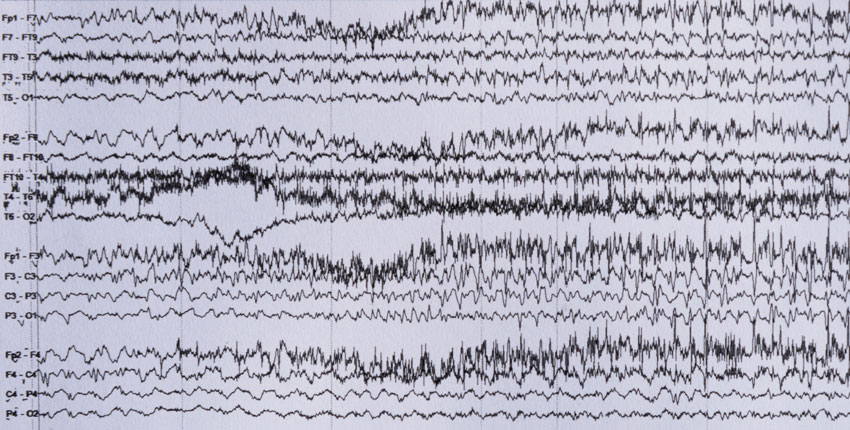 A series of irregularly spiky, black horizontal lines on a white background