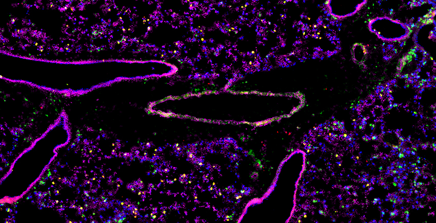 Cross-section of lung tissue shows 6 structures with bright pink outlines and hollow middles, amid purple, green, yellow, and blue dots like a starfield.