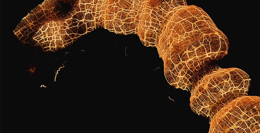 Knob-like segments of colon are webbed with yellow lines indicating neurons